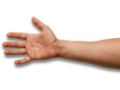 3D Prototype Arm Prothese 3D Prototype Arm Prothese