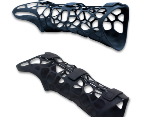3D Prototype Prothese 3D Prototype Prothese
